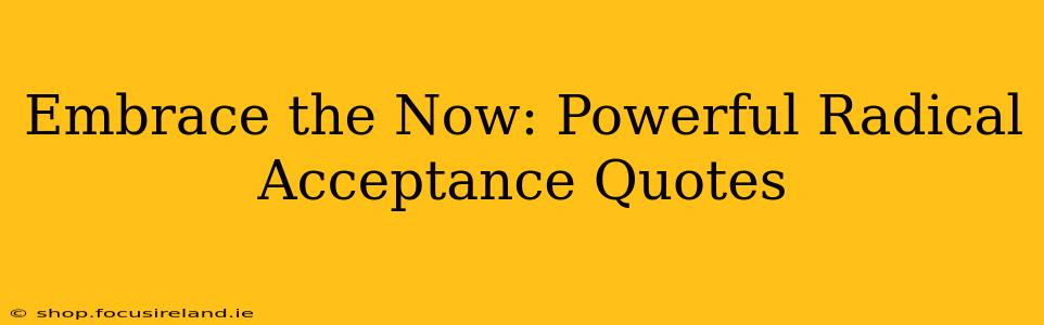 Embrace the Now: Powerful Radical Acceptance Quotes